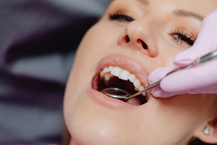 woman getting dental crowns
